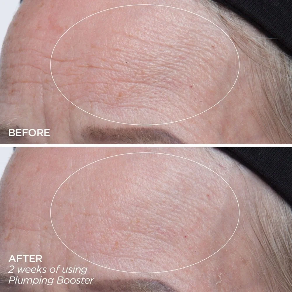 BeautyBio - Plumping Booster | Hyaluronic Acid Line-Filling & Plumping Treatment